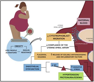 Obesity and Preeclampsia: Common Pathophysiological Mechanisms